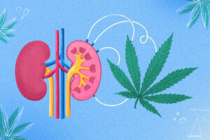 Cannabis Use Associated With Lower Kidney Stone Risk